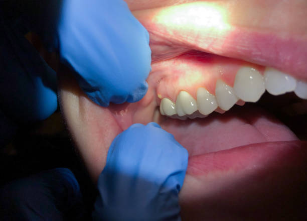 Best Emergency Treatment for Jaw Pain or Injury in Poquoson, VA