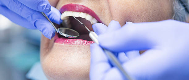 Best Knocked-Out Tooth (Avulsed Tooth) Treatment in Poquoson, VA
